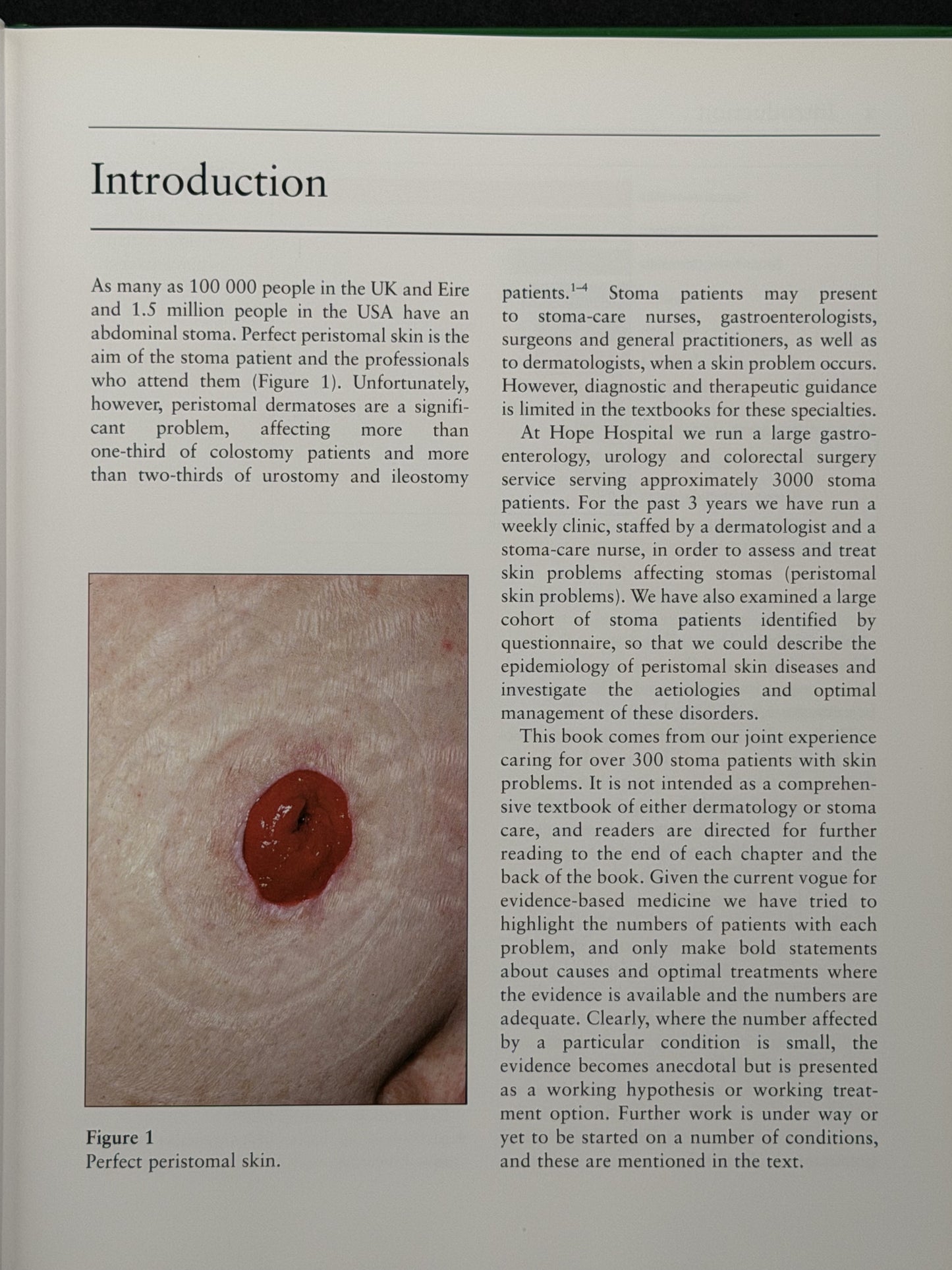 Abdominal Stomas and their Disorders by Calum C Lyon, Amanda J Smith